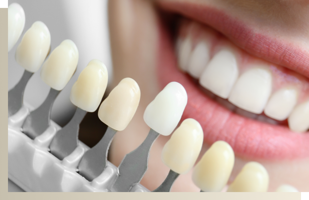 ホワイトニング